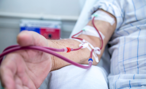 hemodialysis in people on the equipment