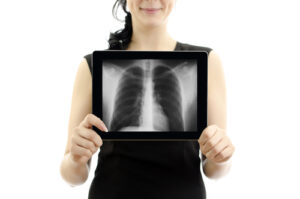 Woman holding tablet with X ray of lungs